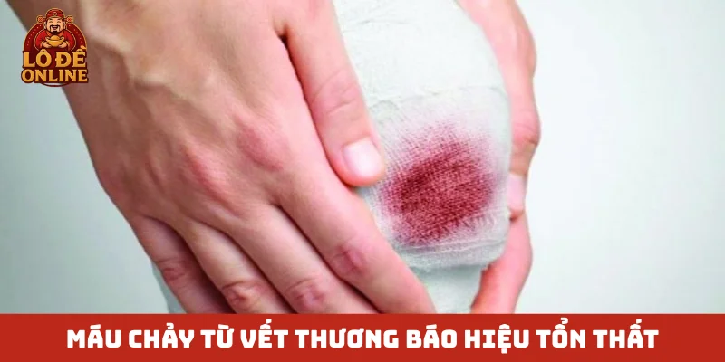 Máu chảy từ vết thương báo hiệu tổn thất